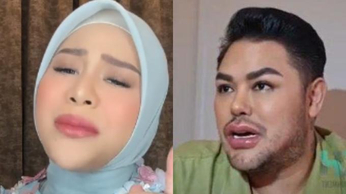 Aurel Hermansyah Bantah Lakukan Filler Bibir, karena Baby Azura Dianggap Mirip Dengannya