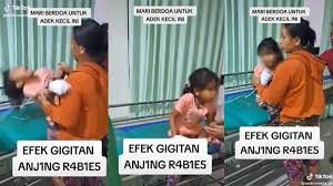 Detik Detik Bocah Penyayang Binatang Tewas Digigit Anjing Rabies Sang Anak Sempat Berontak