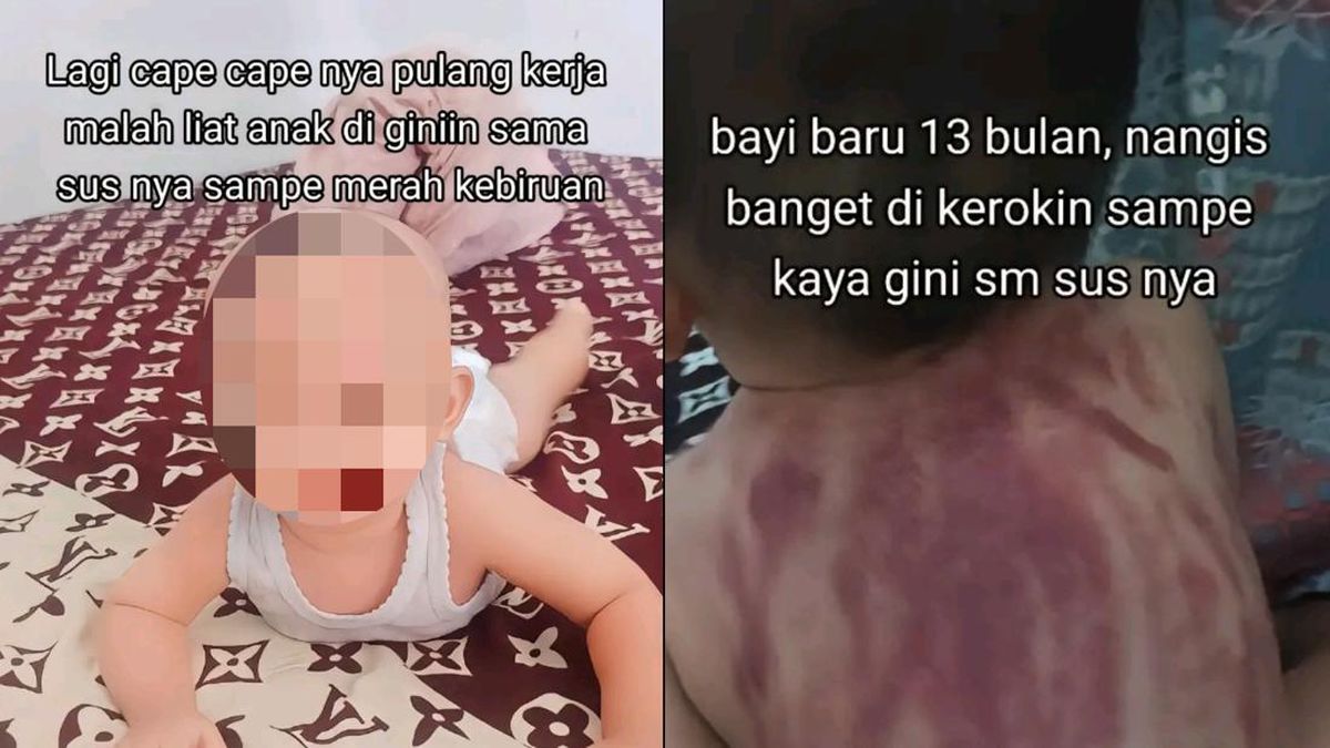 KISAH Pilu Bayi 13 Bulan Dikeroki Pengasuh Sampai Kulit Merah, Ibu Syok Tapi Tetap Maafkan Pelaku