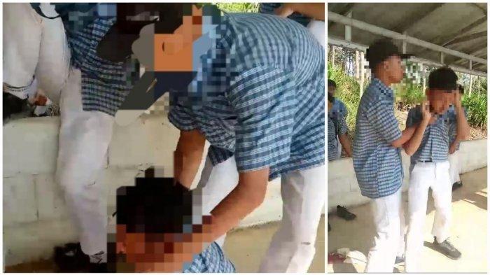 Kondisi Korban Bully di Cilacap Terungkap, Alami Luka Dalam dan Patah Tulang Rusuk