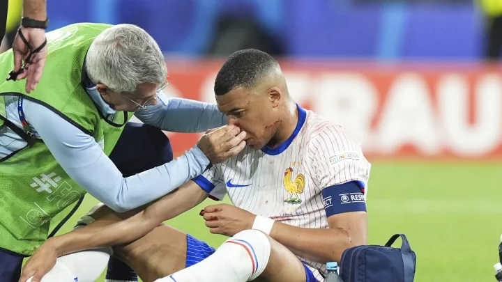 Kylian Mbappe Cedera Hingga Berlumuran Darah di Euro 2024, Ungkap Tak Butuh Operasi 