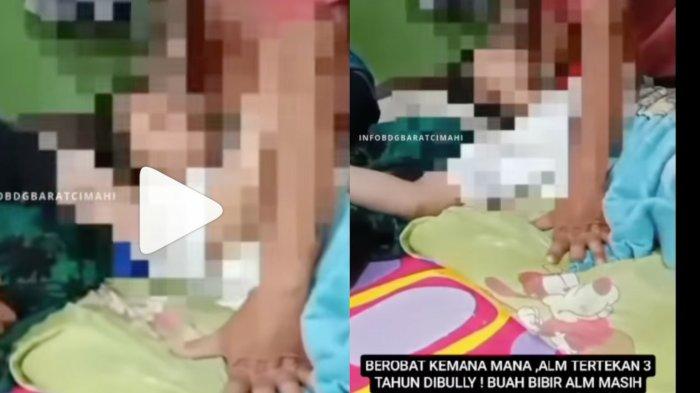 Siswi SMK di Bandung Barat Depresi hingga Meninggal, Diduga Jadi Korban Bully Teman 3 Tahun