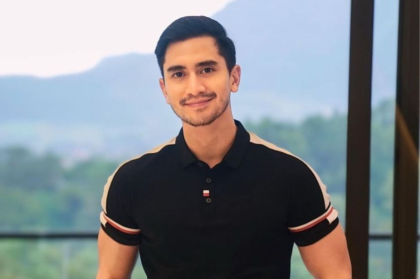 Verrell Bramasta Jalani Transplantasi Rambut di Turki, Dapat Banyak Pujian