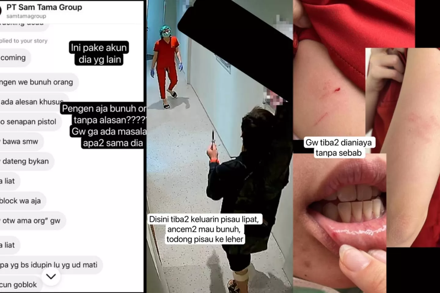 Viral Dokter Gigi jadi Korban Penusukan dengan Pisau Lipat Seorang Pria Misterius di Bandung
