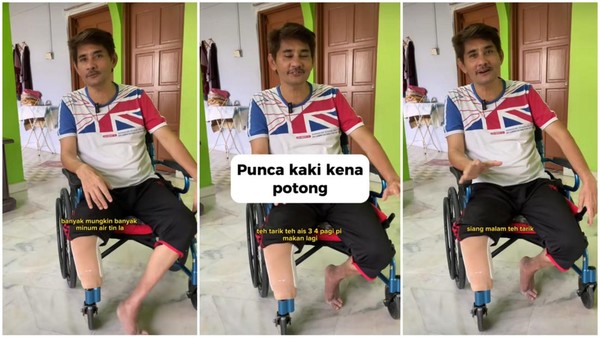 Viral Kaki Pria Harus Diamputasi gegara Minum Teh Tarik 3 Gelas Sehari