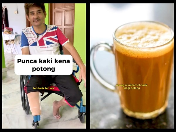 Viral Kaki Pria Harus Diamputasi gegara Minum Teh Tarik 3 Gelas Sehari