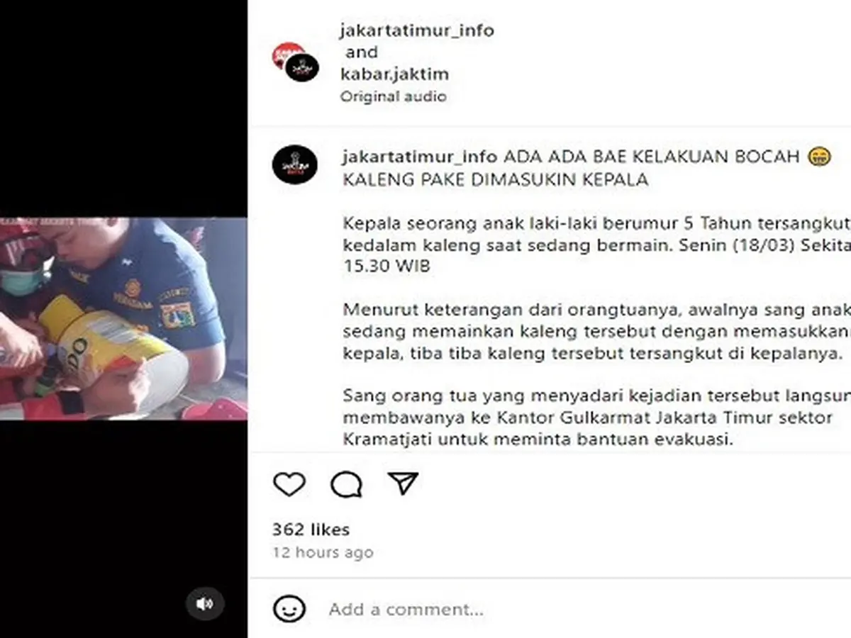 Viral Kepala Bocah di Jaktim Tersangkut Kaleng Susu, Petugas Damkar Turun Tangan