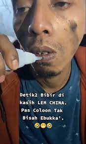 Viral Pria di Madura Nekat Oleskan Lem China ke Bibir, Ending Nasibnya Bikin Pilu