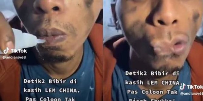 Viral Tingkah Absurd Pria Kasih Lem di Bibir Ini Bikin Eskpresinya Kocak