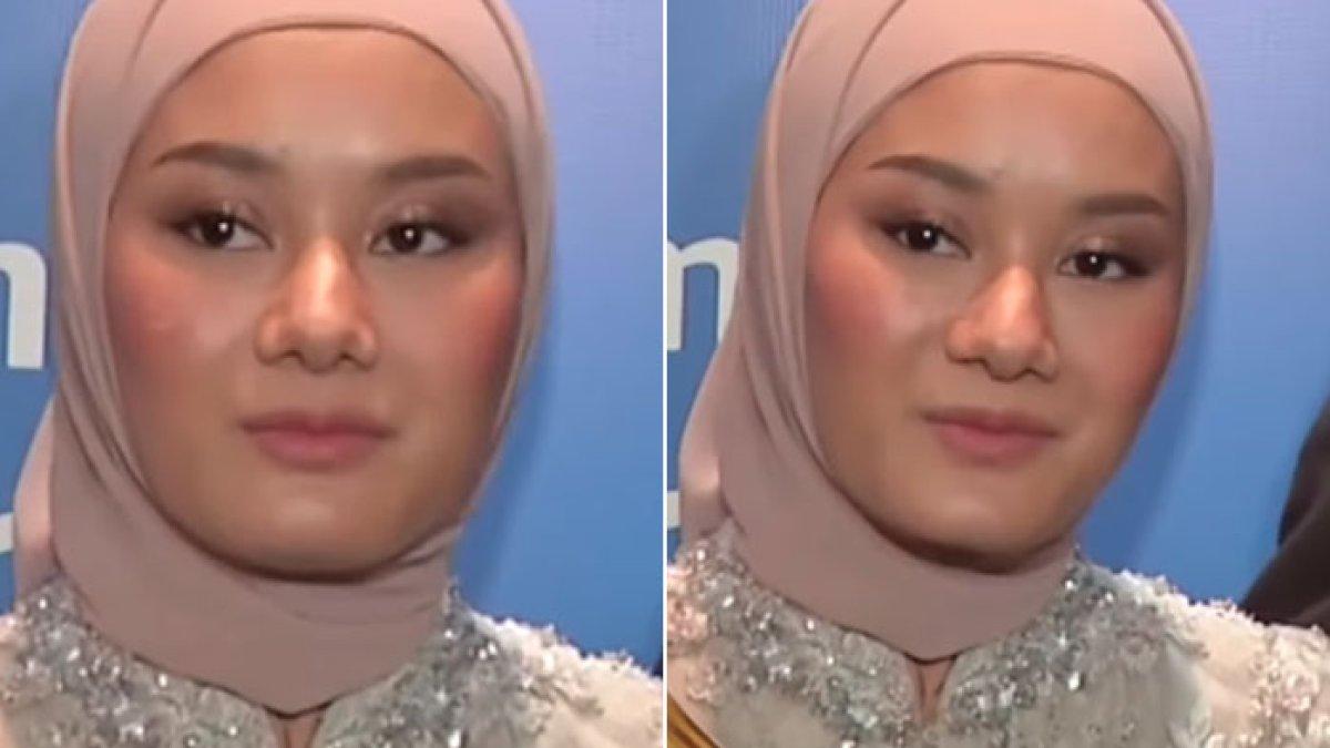 Viral Wajah Dinda Hauw Terkena Kamera Wartawan, Ternyata Begini Aslinya